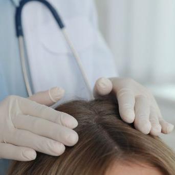 Trichoskopia – konsultacja dermatologa z badaniem