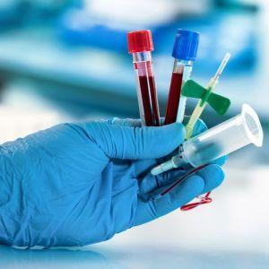 Pakiet badań - profilaktyka HIV (PEP)
