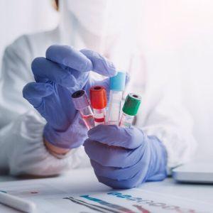 Pakiet badań Witamina D3 i B12