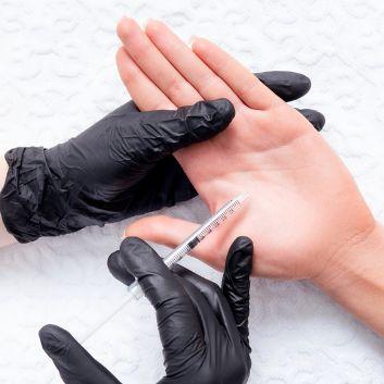 Toksyna Botulinowa botox/vistabel - leczenie nadpotliwości dłoni