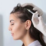 Scalp Mesotherapy