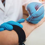 EMG - badanie nerwu w zespole rowka n.łokciowego