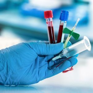 Pakiet badań - profilaktyka HIV (PEP)