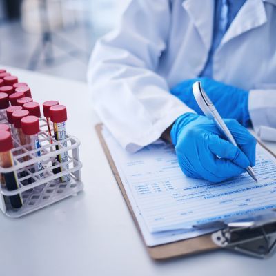 Total PSA test