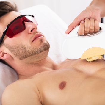 Pakiet 3 zabiegów epilacji laserowej – klatka piersiowa (dla panów)