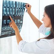 Rtg ręki zdjęcie boczne