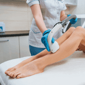 Depilacja laserowa (epilacja) łydek dla pań