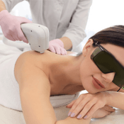 Depilacja laserowa (epilacja) ramion